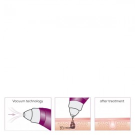 Очиститель пор Beurer FC 40 107733